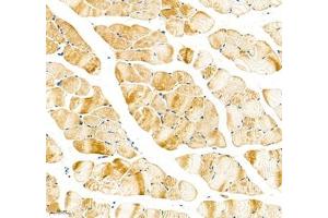 Immunohistochemistry of paraffin embedded mouse skeletal muscle using Sarcomeric α Actinin (ABIN7075510) at dilution of 1:1000 (200x lens) (Sarcomeric alpha Actinin anticorps)