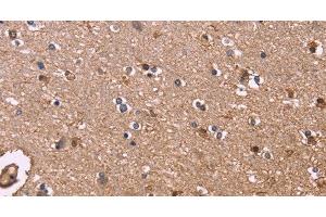 Immunohistochemistry of paraffin-embedded Human brain tissue using S100A13 Polyclonal Antibody at dilution 1:40 (S100A13 anticorps)