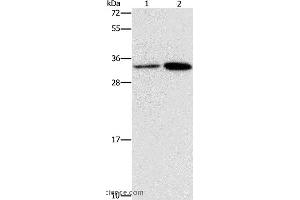 Western blot analysis of Hela and A431 cell, using CDC34 Polyclonal Antibody at dilution of 1:900 (CDC34 anticorps)