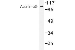 Image no. 1 for anti-Actinin, alpha 3 (ACTN3) antibody (ABIN272284) (ACTN3 anticorps)