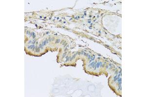 Immunohistochemistry of paraffin-embedded human trachea using NDUFB5 antibody. (NDUFB5 anticorps)