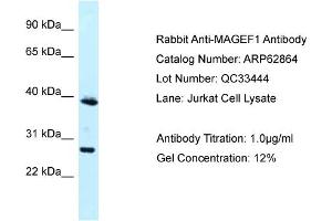 Western Blotting (WB) image for anti-Melanoma Antigen Family F, 1 (MAGEF1) (N-Term) antibody (ABIN2789273) (MAGEF1 anticorps  (N-Term))