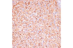 Immunohistochemistry of paraffin-embedded rat ovary using C1 antibody (ABIN7265723) at dilution of 1:100 (40x lens).
