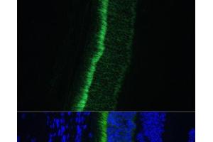 Immunofluorescence analysis of Mouse eye using GNGT1 Polyclonal Antibody at dilution of 1:100 (40x lens). (GNGT1 anticorps)