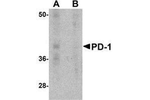 Western Blotting (WB) image for anti-Programmed Cell Death 1 (PDCD1) antibody (ABIN1031789)