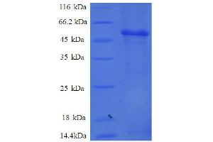 SDS-PAGE (SDS) image for Proteasome Subunit alpha  7 (PSMA7) (AA 44-275), (partial) protein (GST tag) (ABIN5712137)