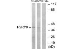 Western blot analysis of extracts from HeLa/HuvEc cells, using P2RY8 Antibody. (P2RY8 anticorps  (AA 192-241))