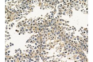 VAPA Mouse Monoclonal Antibody at 1/100 staining mouse testis tissue by IHC-P. (VAPA anticorps)