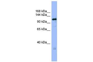 WB Suggested Anti-FAM29A Antibody Titration: 0. (FAM29A anticorps  (Middle Region))