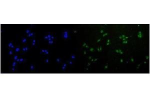 IF analysis of Rad51 using anti-Rad51 antibody (ABIN6719396). (RAD51 anticorps)