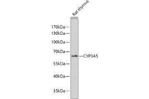 Western blot analysis of extracts of Rat thymus, using CYP3 antibody (ABIN6130166, ABIN6139354, ABIN6139355 and ABIN6223584) at 1:1000 dilution. (CYP3A5 anticorps  (AA 233-502))