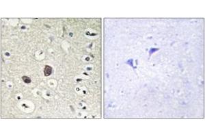 Immunohistochemistry analysis of paraffin-embedded human brain tissue, using TIE2 (Ab-1102) Antibody. (TEK anticorps  (AA 1068-1117))