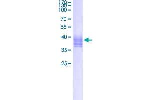 Image no. 2 for Epithelial Cell Adhesion Molecule (EPCAM) (AA 24-265) protein (His-DYKDDDDK-Strep II Tag) (ABIN2752784)