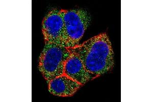 Confocal immunofluorescent analysis of AGL Antibody (C-term) (ABIN389030 and ABIN2839247) with HepG2 cell followed by Alexa Fluor 488-conjugated goat anti-rabbit lgG (green).