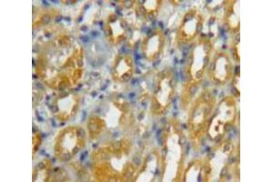 Used in DAB staining on fromalin fixed paraffin-embedded Kidney tissue (CCL8 anticorps  (AA 1-99))