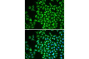 Immunofluorescence analysis of HeLa cells using COPS5 antibody. (COPS5 anticorps  (AA 1-334))