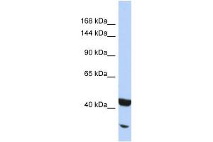 Host:  Rabbit  Target Name:  NFKB2  Sample Type:  Jurkat Whole cell lysates  Antibody Dilution:  1. (NFKB2 anticorps  (N-Term))