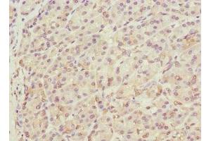 Immunohistochemistry of paraffin-embedded human pancreatic tissue using ABIN7172143 at dilution of 1:100 (THADA anticorps  (AA 1684-1953))