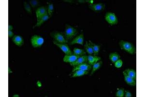 Immunofluorescent analysis of HepG2 cells using ABIN7156659 at dilution of 1:100 and Alexa Fluor 488-congugated AffiniPure Goat Anti-Rabbit IgG(H+L)