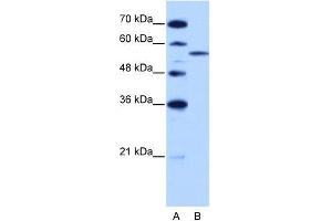 Human HepG2; WB Suggested Anti-ZRSR2 Antibody Titration: 2. (ZRSR2 anticorps  (C-Term))