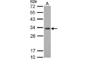WB Image ING5 antibody [N2C1], Internal detects ING5 protein by Western blot analysis. (ING5 anticorps)