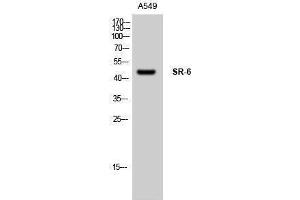 Western Blotting (WB) image for anti-Serotonin Receptor 6 (HTR6) (Internal Region) antibody (ABIN3177509) (Serotonin Receptor 6 anticorps  (Internal Region))