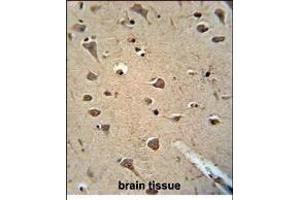 Paraformaldehyde-fixed, paraffin embedded Human brain tissue, Antigen retrieval by boiling in sodium citrate buffer (pH6.
