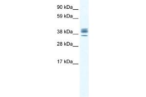 ESX1 antibody (20R-1122) used at 0. (ESX Homeobox 1 anticorps  (N-Term))