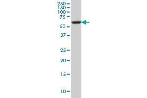 FAAH monoclonal antibody (M07), clone 4H8 Western Blot analysis of FAAH expression in A-431 . (FAAH anticorps  (AA 480-579))