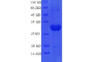 SDS-PAGE (SDS) image for Janus Kinase 3 (JAK3) (AA 818-110) protein (His tag) (ABIN5711395)