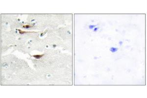 Immunohistochemistry (IHC) image for anti-Inositol 1,3,4,5,6-Pentakisphosphate 2-Kinase (IPPK) (N-Term) antibody (ABIN1849982) (IPPK anticorps  (N-Term))