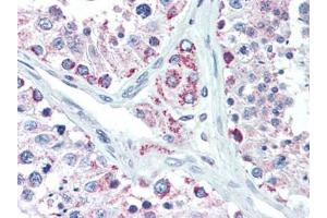 Human Testis (formalin-fixed, paraffin-embedded) stained with LIN28Bfollowed by biotinylated goat anti-rabbit IgG secondary antibody, alkaline phosphatase-streptavidin and chromogen. (LIN28B anticorps  (N-Term))