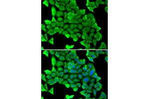 Immunofluorescence analysis of U2OS cells using MYH1 antibody (ABIN5974170). (MYH1 anticorps)