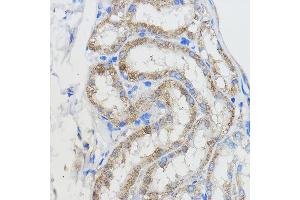 Immunohistochemistry of paraffin-embedded Mouse kidney using CYP51 Rabbit pAb (3485) at dilution of 1:50 (40x lens). (CYP51A1 anticorps  (AA 210-509))