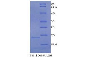 SDS-PAGE (SDS) image for Carcinoembryonic Antigen Gene Family (CEA) (AA 85-222) protein (His tag) (ABIN1980682)
