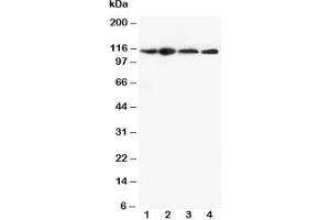Western blot testing of NLRP3 antibody and Lane 1:  HEP-2;  2: A549;  3: U87;  4: CEM cell lysate (NLRP3 anticorps  (N-Term))