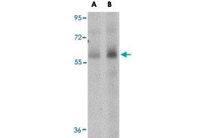 Western blot analysis of SCARB1 in human spleen tissue lysate with SCARB1 polyclonal antibody  at (A) 1 and (B) 2 ug/mL . (SCARB1 anticorps  (N-Term))