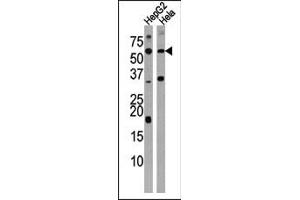 ACVR1C/ALK7 anticorps  (N-Term)