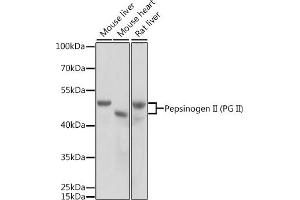 Western blot analysis of extracts of various cell lines, using Pepsinogen II (PG II) antibody (ABIN3016694, ABIN3016695, ABIN3016696 and ABIN6219816) at 1:1000 dilution. (PGC anticorps  (AA 100-200))