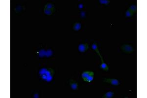 anti-BCL2/adenovirus E1B 19kDa Interacting Protein 3 (BNIP3) (AA 1-164) antibody