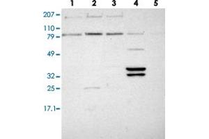 Western blot analysis of lane 1: RT-4, lane 2: EFO-21, lane 3: A-431, lane 4: Liver and lane 5: Tonsi lusing PLEK2 polyclonal antibody . (Pleckstrin 2 anticorps)