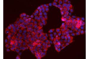 IF analysis of TOMM70 using anti-TOMM70 antibody (ABIN7599855). (TOM70 anticorps  (AA 122-608))