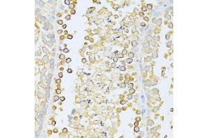 Immunohistochemistry of paraffin-embedded mouse testis using MAP1LC3B antibody (ABIN6291773) at dilution of 1:100 (40x lens). (LC3B anticorps)
