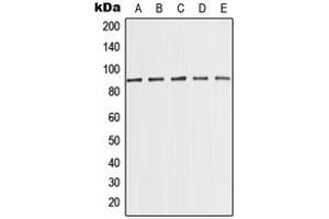 Western blot analysis of MED15 expression in MCF7 (A), K562 (B), HeLa (C), NIH3T3 (D), PC12 (E) whole cell lysates. (MED15 anticorps  (Center))