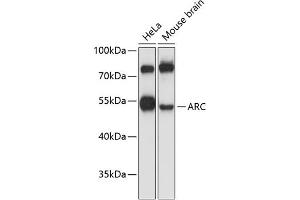Western blot analysis of extracts of various cell lines, using ARC antibody (ABIN6131195, ABIN6137063, ABIN6137064 and ABIN6224919) at 1:3000 dilution. (ARC (AA 1-220) anticorps)