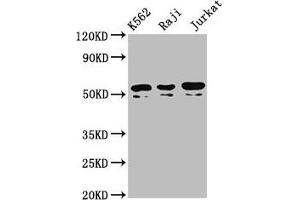 Western Blot Positive WB detected in: K562 whole cell lysate, Raji whole cell lysate, Jurkat whole cell lysate All lanes: TOX2 antibody at 4. (TOX2 anticorps  (AA 303-417))