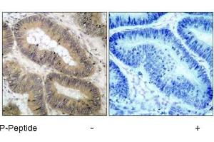 Image no. 1 for anti-conserved Helix-Loop-Helix Ubiquitous Kinase (CHUK) (pThr23) antibody (ABIN196837) (IKK alpha anticorps  (pThr23))
