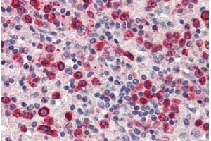 Human Spleen (formalin-fixed, paraffin-embedded) stained with ZBTB7A antibody ABIN337217 at 2. (ZBTB7A anticorps  (C-Term))