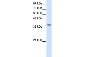 WB Suggested Anti-EIF4G2 Antibody Titration:  0. (EIF4G2 anticorps  (C-Term))