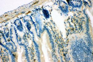 Anti- IRS1 antibody, IHC(P) IHC(P): Mouse Intestine Tissue